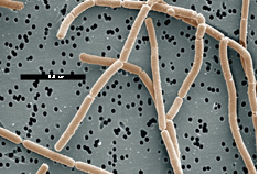 Trực khuẩn lactobacillus bulgaricus: